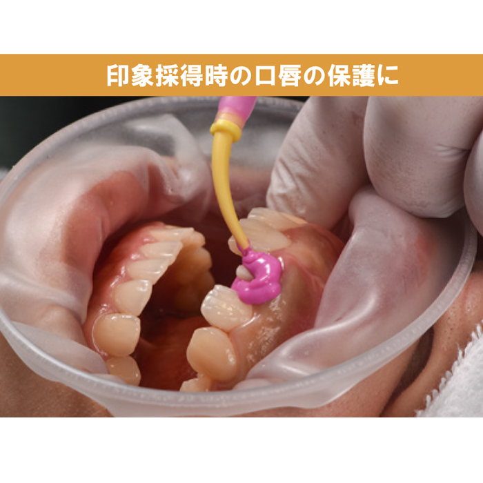 製品詳細「チークリトラクターLF」 | フォルディネット