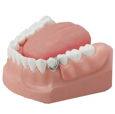 製品詳細「口腔ケア指導用顎模型」 | フォルディネット