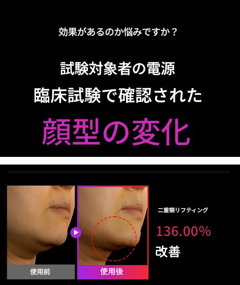 Qoo10] マミケアEMS V-Thera美顔器/中