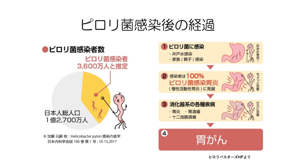 胃がん最新治療を全解説 / 内視鏡手術 / 胃切除術 / ピロリ菌 / 免疫