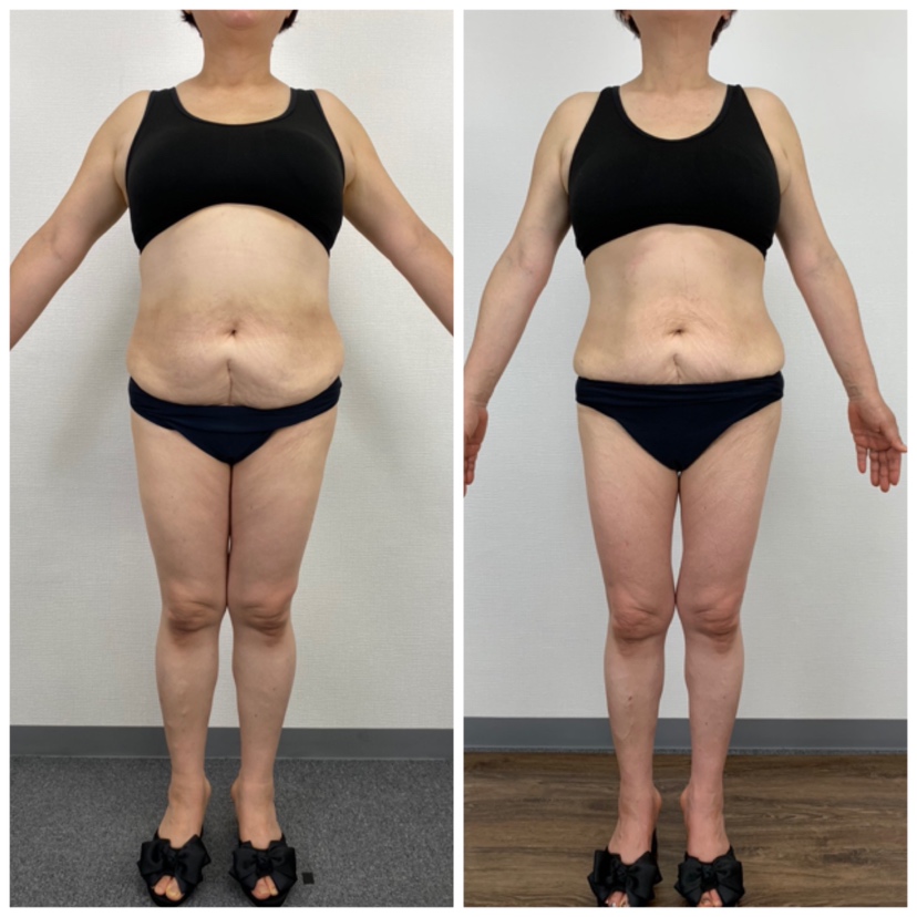 氷川きよしのCMが話題】美容機器メーカーのNBSとは？ - 業務用痩身機器