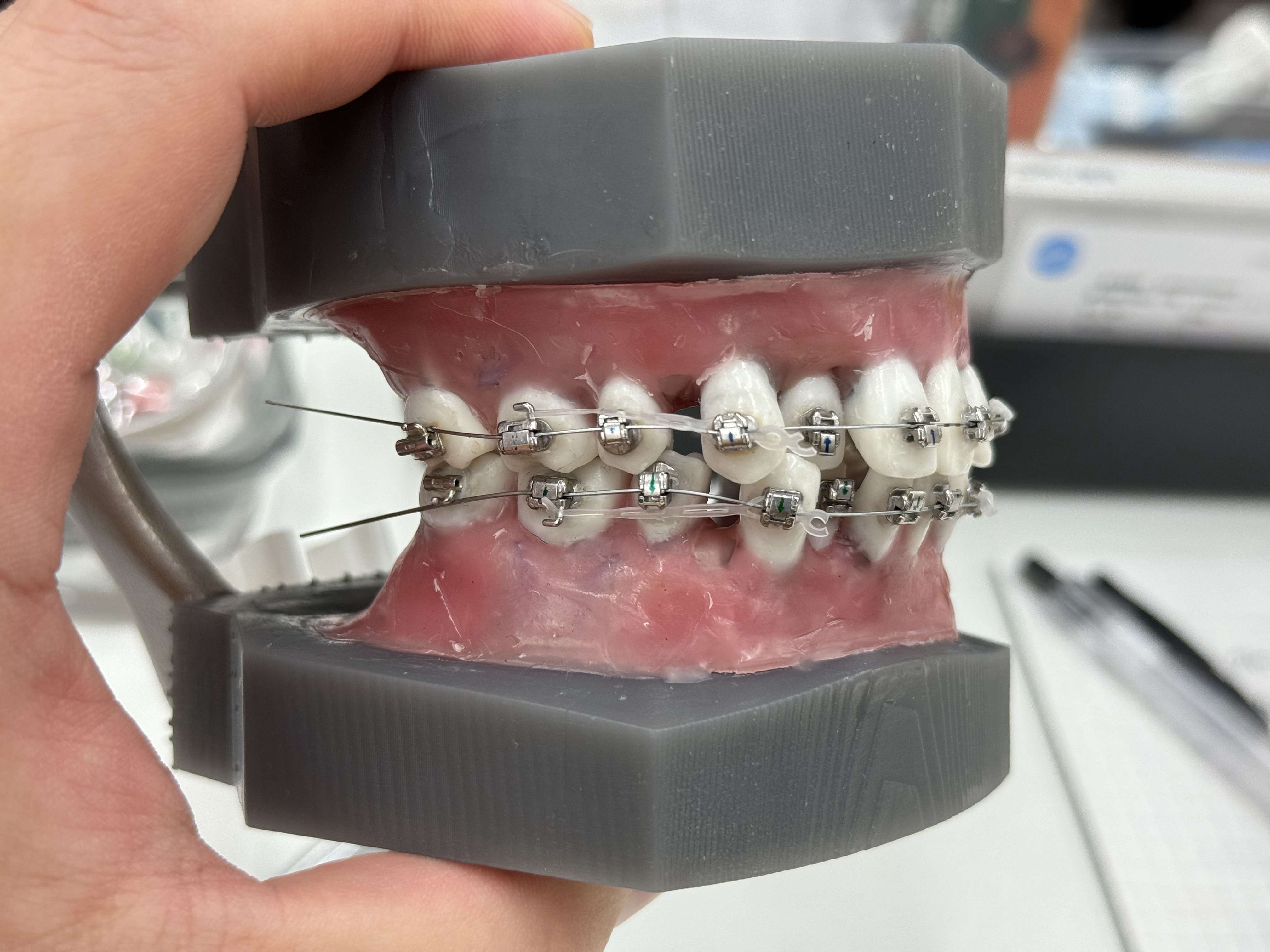 矯正セミナーに行ってきましたin兵庫〜タイポドント実習〜② - 医療
