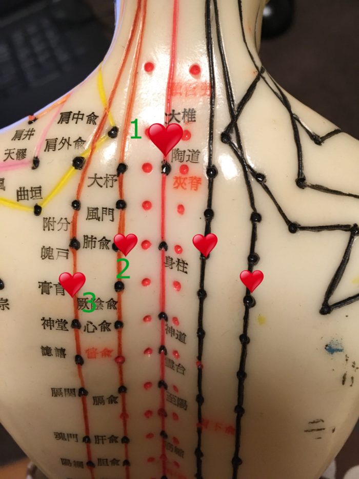 中華圏の人たちのケア「夏病冬治」三九天灸、「冬病夏治」三伏貼