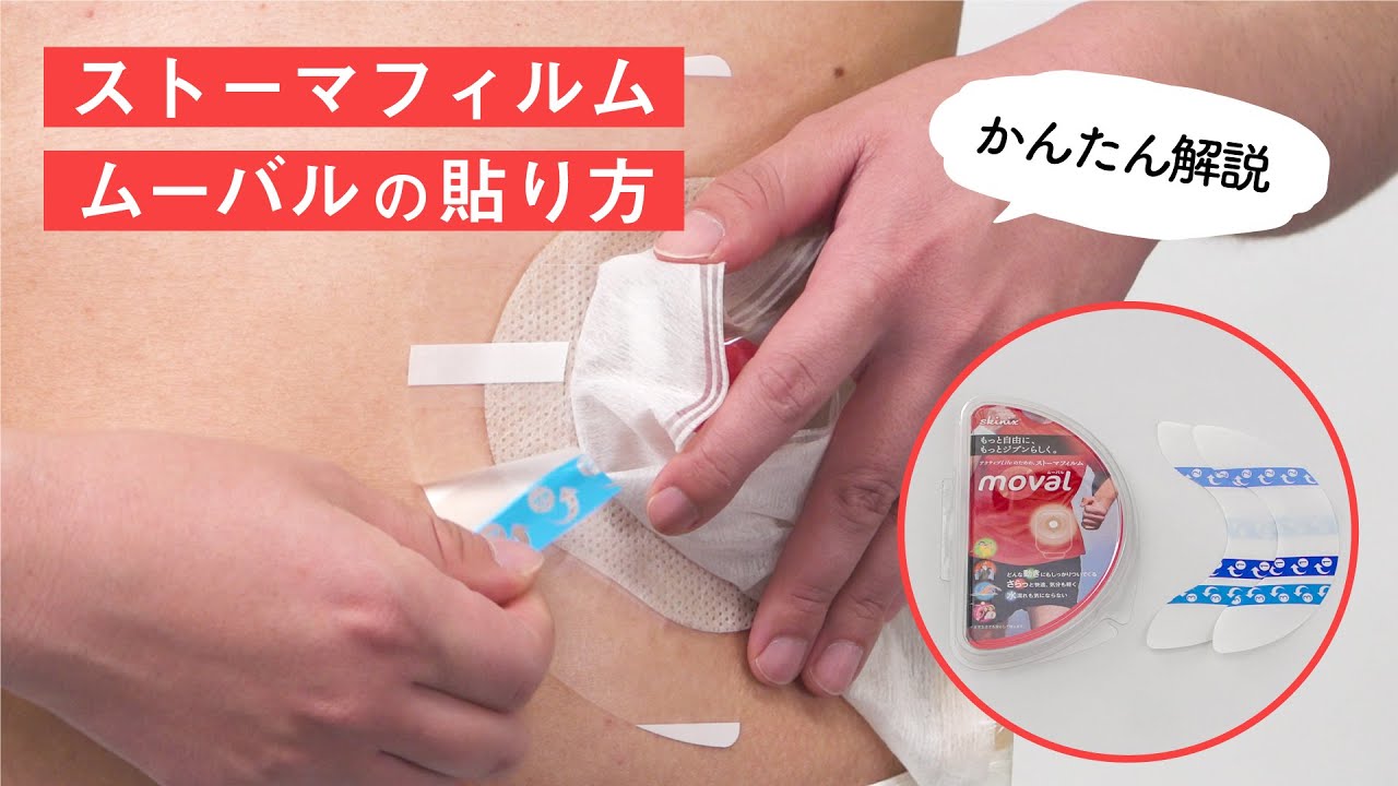 ムーバル 公式】アクティブLifeのための、ストーマフィルム・ストーマ