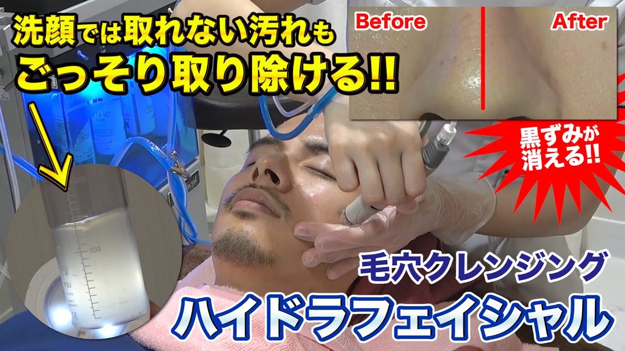 Pore Cleansing] Popular with men too! Experience the HydraFacial