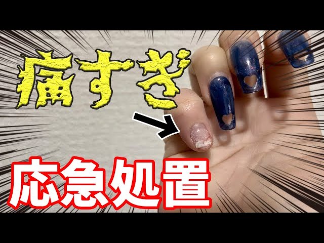 痛すぎる！！】ネイルが折れた時の対処法 ※グロ注意 - YouTube