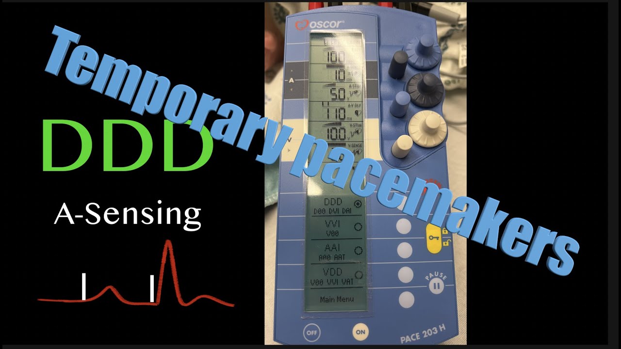 Temporary pacemakers 101: set up and modes - YouTube