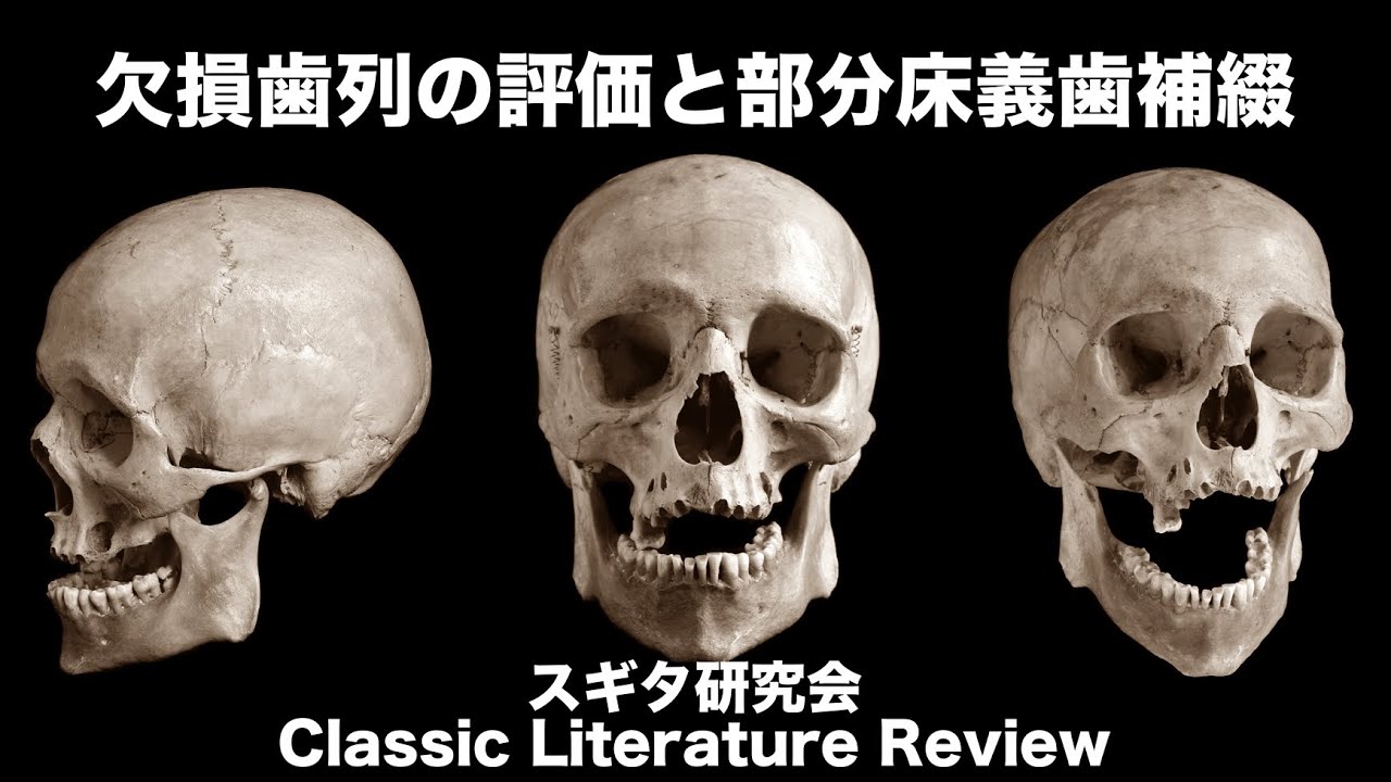 見る目が変わる！欠損歯列の読み方 裁断済】見る目が変わる！ 「欠損歯