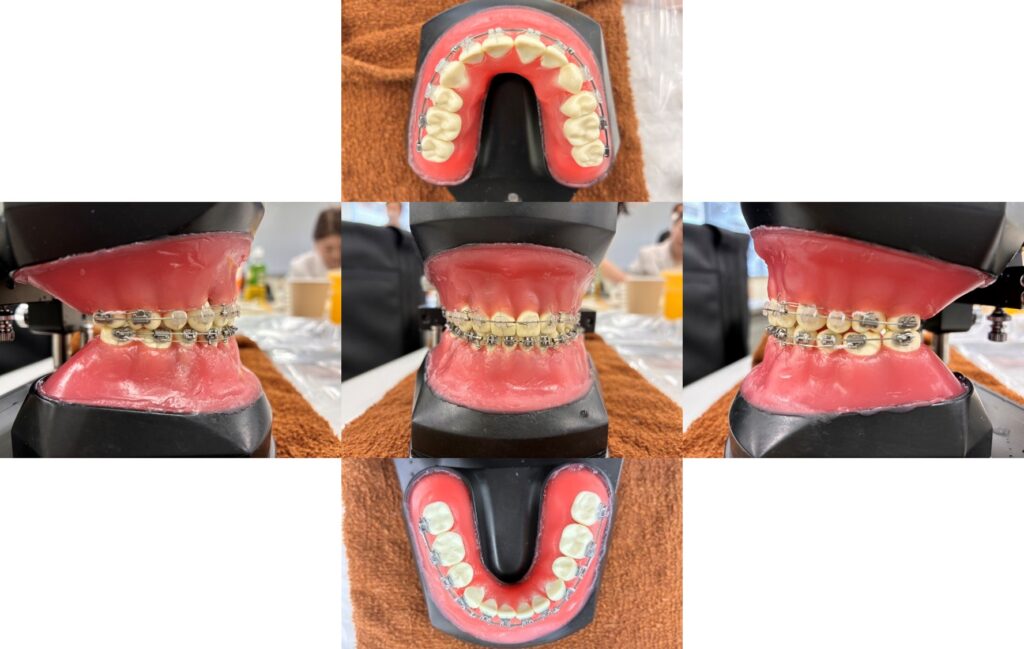 学際企画主催「第2期 タイポドント模型で習得するストレートワイヤー