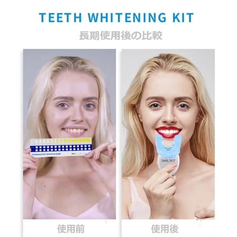 SMILEKIT 歯ホワイトニングキット LED 歯のホワイトニング デンタル