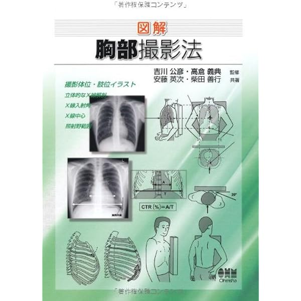 図解 頭部・頸部撮影法 | 安藤 英次, 薮内 安成, 榊 壽右, 高倉 義典