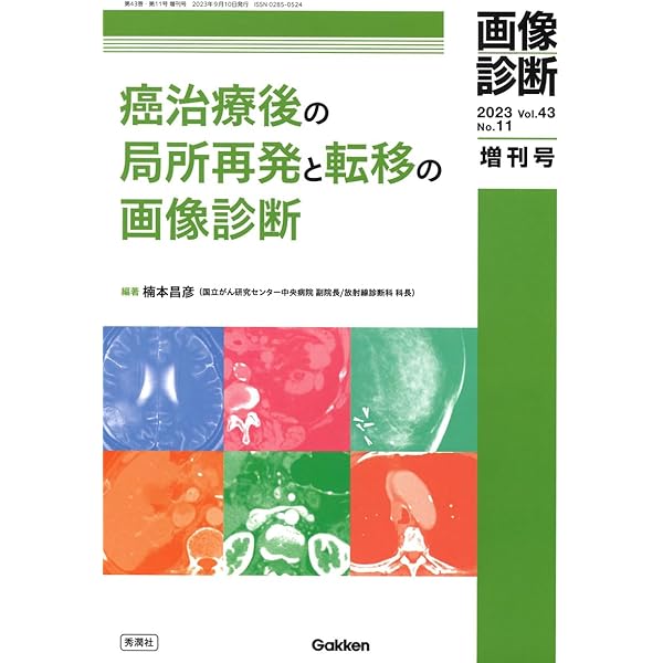 画像診断2022年増刊号Vol.42 No.11: 画像でみかける偶発的所見の
