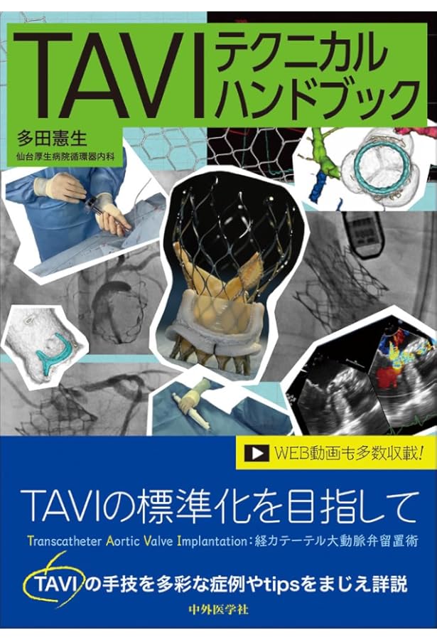 ステントグラフト内挿術マニュアル 腹部編【動画を含む電子版付