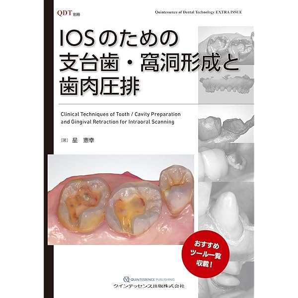 Amazon.co.jp: 臨床の玉手箱 保存修復編 : 鷹岡竜一, 大谷一紀, 鎌田