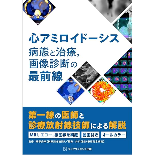 アミロイドーシス診療ガイドライン2025 | 日本アミロイドーシス学会