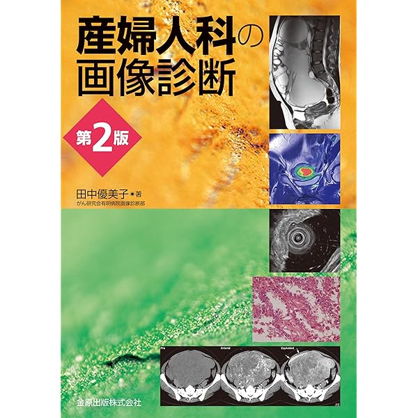 ジェネラリストを目指す人のための 画像診断パワフルガイド 第2版