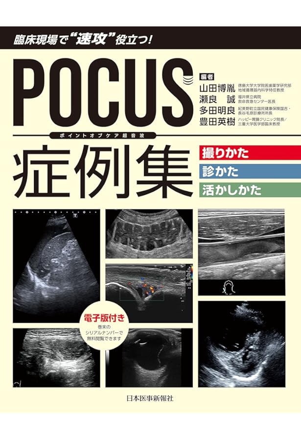 Point-of-Care超音波 原書第2版 ―電子書籍(日本語・英語版)付 | Nilam