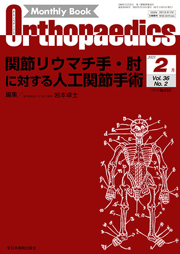 Orthopaedics（オルソペディクス） Vol.36 No.2 (発売日2023年02月15日