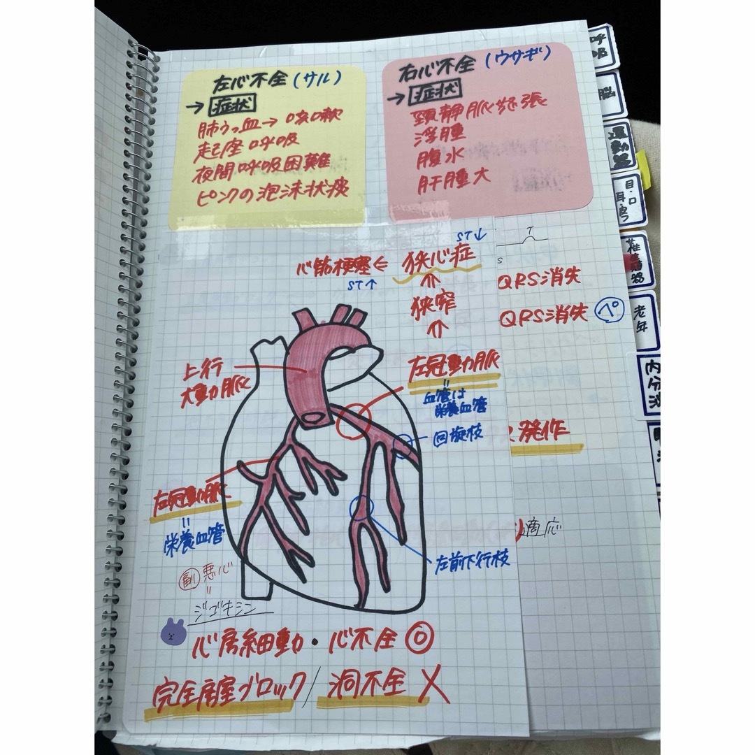 看護師国家試験対策【必修＋レビュー2点セット！！】国試ノート 付箋