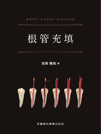 根管充填 吉岡 隆知(編) - 医歯薬出版 | 版元ドットコム