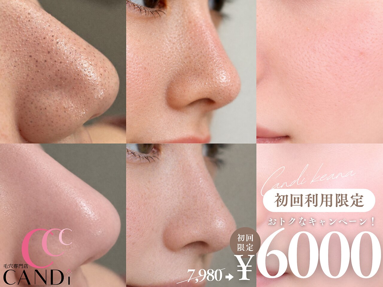 キャンディ 難波心斎橋店(CANDi)｜ホットペッパービューティー