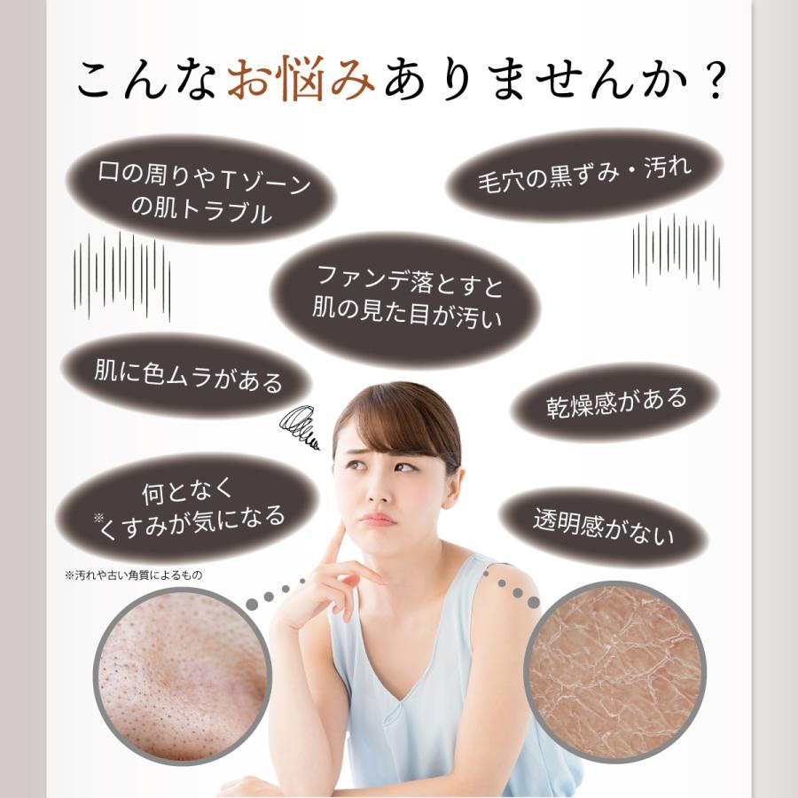 LINKA（リンカ） 美顔器 ニキビケア クリアズム プラズマ美顔器 毛穴