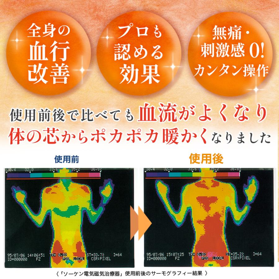 電気（交流）磁気治療器 ソーケンリラックス 延長保証付 ソーケン