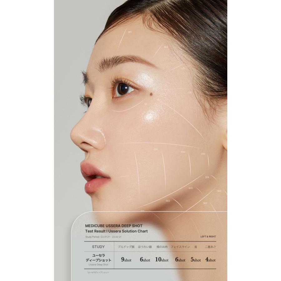 ハイフ美顔器 ユーセラディープショット : sun lise - 通販 - Yahoo