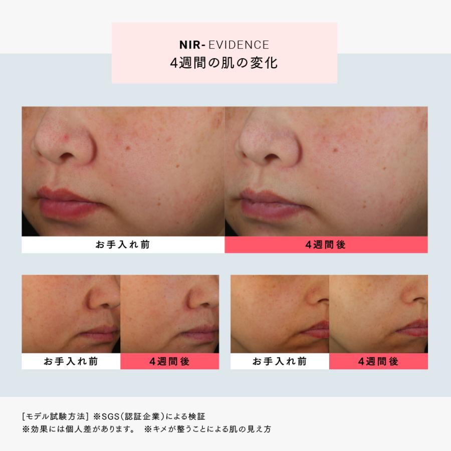 MYTREX（マイトレックス） 公式 MiRAY 専用 NIR リフト アタッチメント