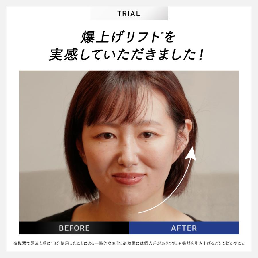 MYTREX（マイトレックス） 「30日間返品保証」美顔器 EMS MYTREX 公式