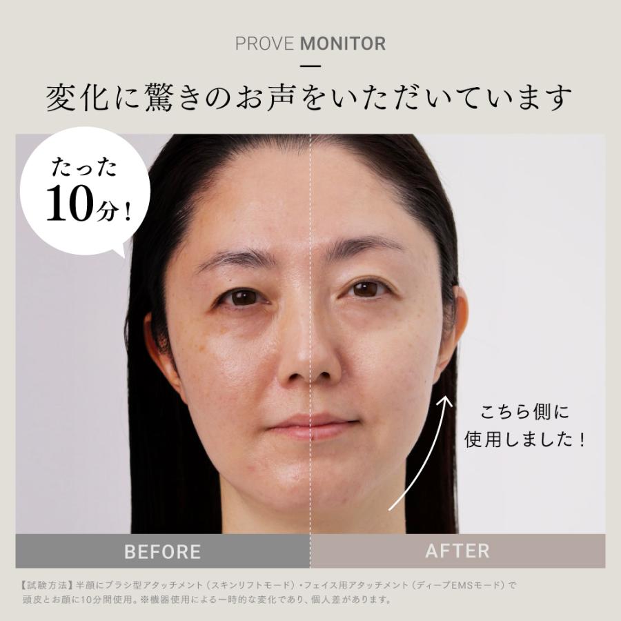 MYTREX（マイトレックス） 「30日間返品保証」美顔器 EMS MYTREX 公式