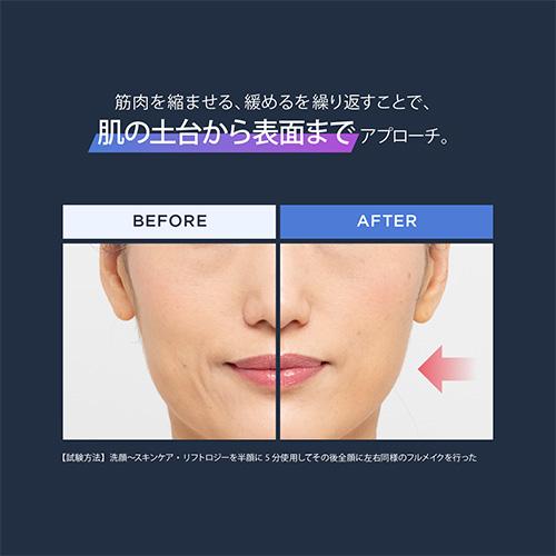 YA‐MAN（ヤーマン） 美顔器 リフトロジー 公式 リフトアップ