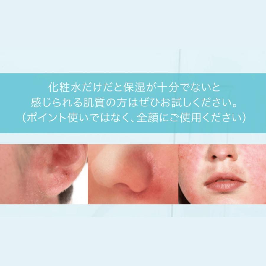 KADASON（カダソン） 【公式】KADASON モイストセラム 薬用保湿美容液