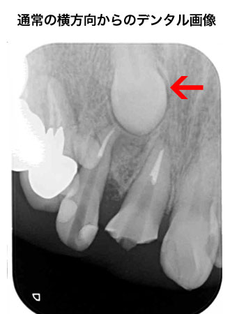 デジタルレントゲン | 風間歯科医院｜中野市・飯山市・須坂市・長野市