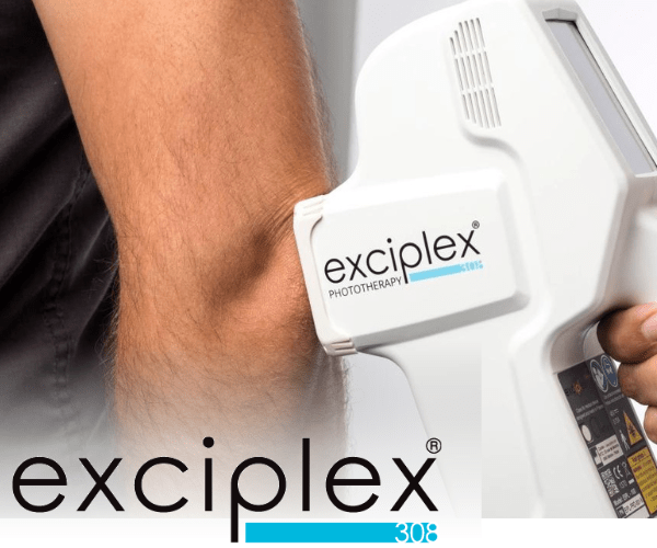 ナローバンドUVB療法（全身型、部分型） - 板橋区成増駅前かわい皮膚科