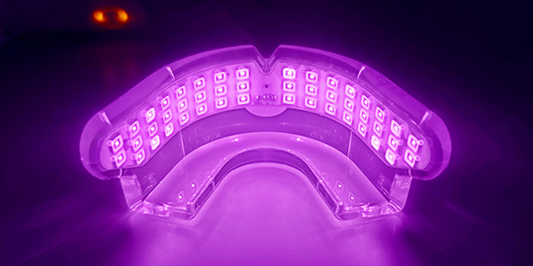 早い歯列矯正・加速矯正 | 鹿児島の矯正歯科｜かわなべ矯正歯科クリニック