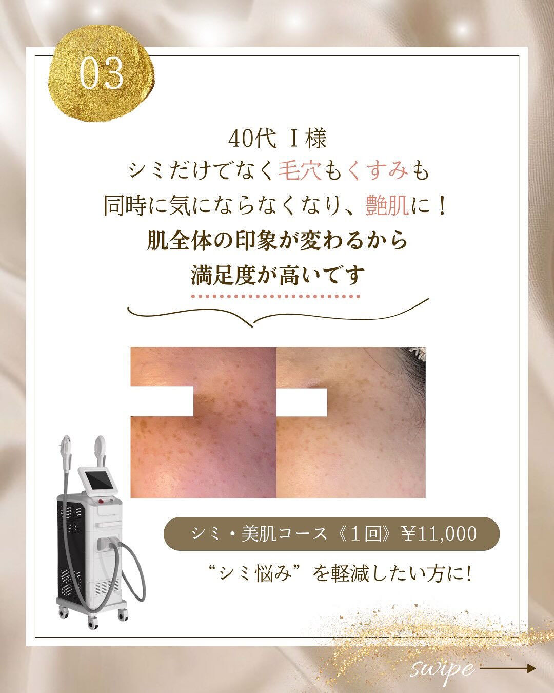 高知県高知市にある | ブログ | 高知のエステならシミ・そばかす・肝斑