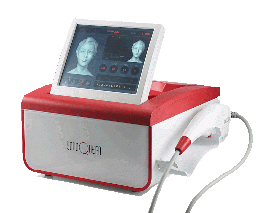 HIFU（ソノクイーン）｜美容皮膚科｜ことに皮フ科クリニック