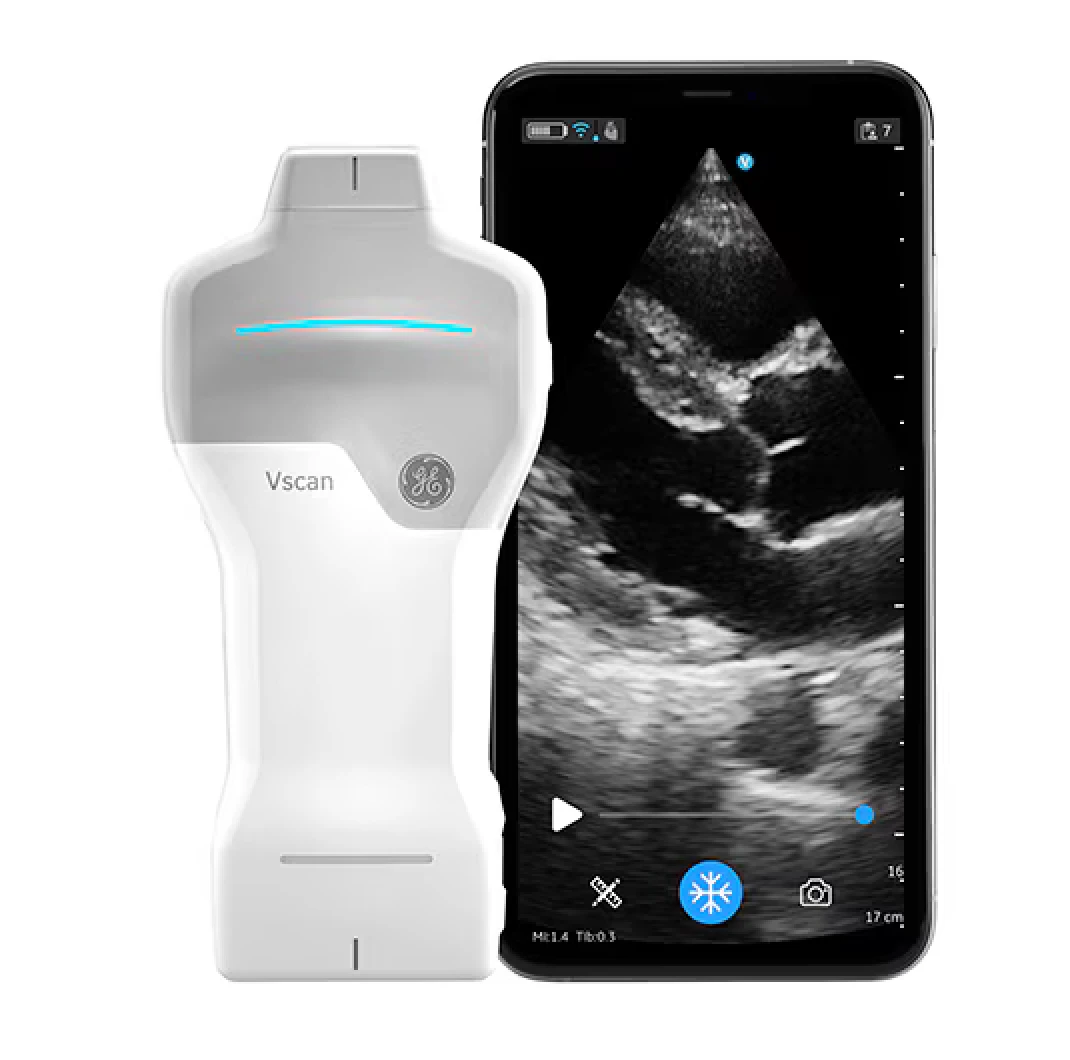 GEヘルスケア製品 ポケットタイプ 超音波診断装置｜株式会社 協栄