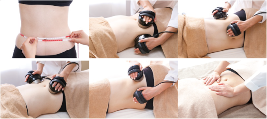 痩身機器の説明｜｜LAPIS-ASHLEY_ラピスアシュレイ長野市JR長野駅前