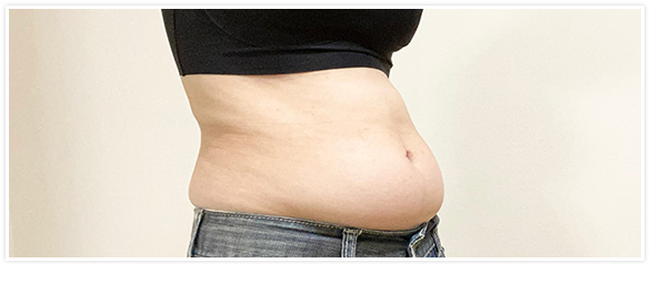 EM Slender（エムスレンダー） | エステ業務用美容機器販売の株式会社L.H.B