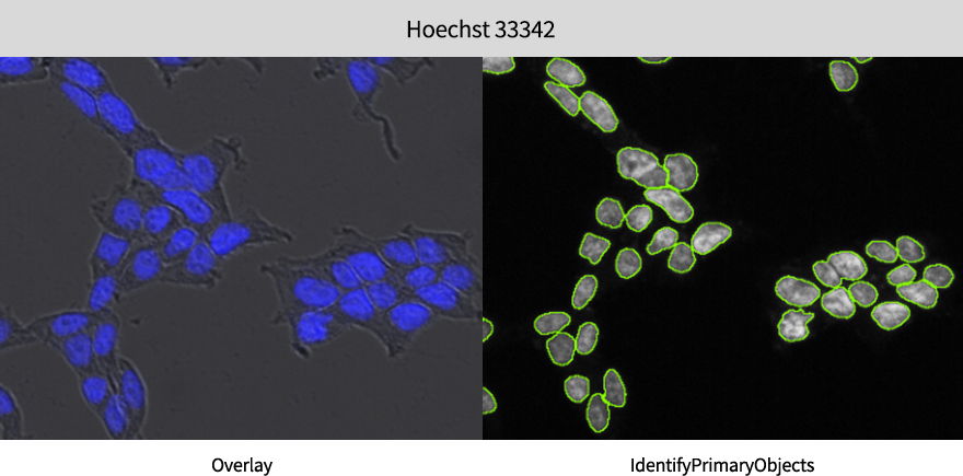 Automated Adherent Cell Counting with CELENA-X High-Content System