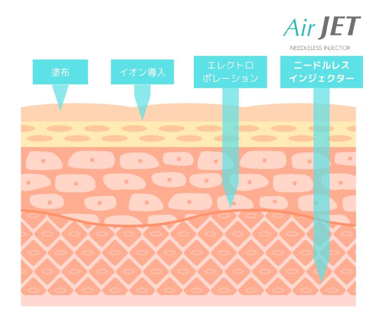 針を刺さない高圧ジェット。最先端美容ニードルレスインジェクター