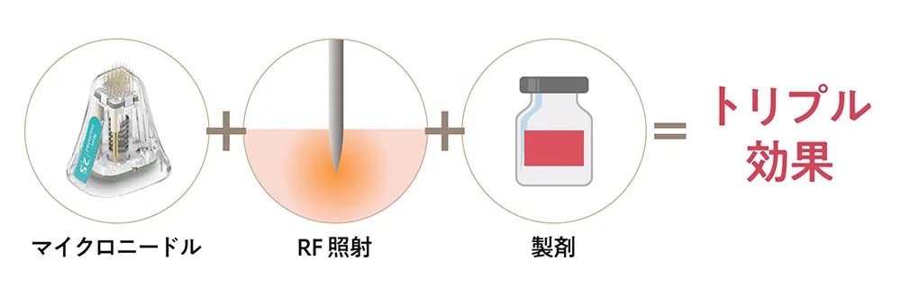 美容液導入 針なしポテンツァ 【ドリーガン】ダウンタイム無く美肌管理