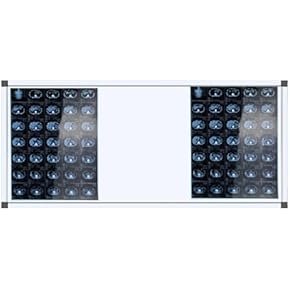 Amazon.co.jp: シャウカステン - 放射線学・画像診断: 産業・研究開発用品