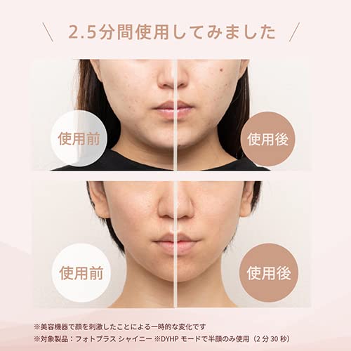 徹底検証】ヤーマン RF美顔器 フォトプラス シャイニー M18YLの