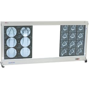 Amazon.co.jp: シャウカステン - 放射線学・画像診断: 産業・研究開発用品