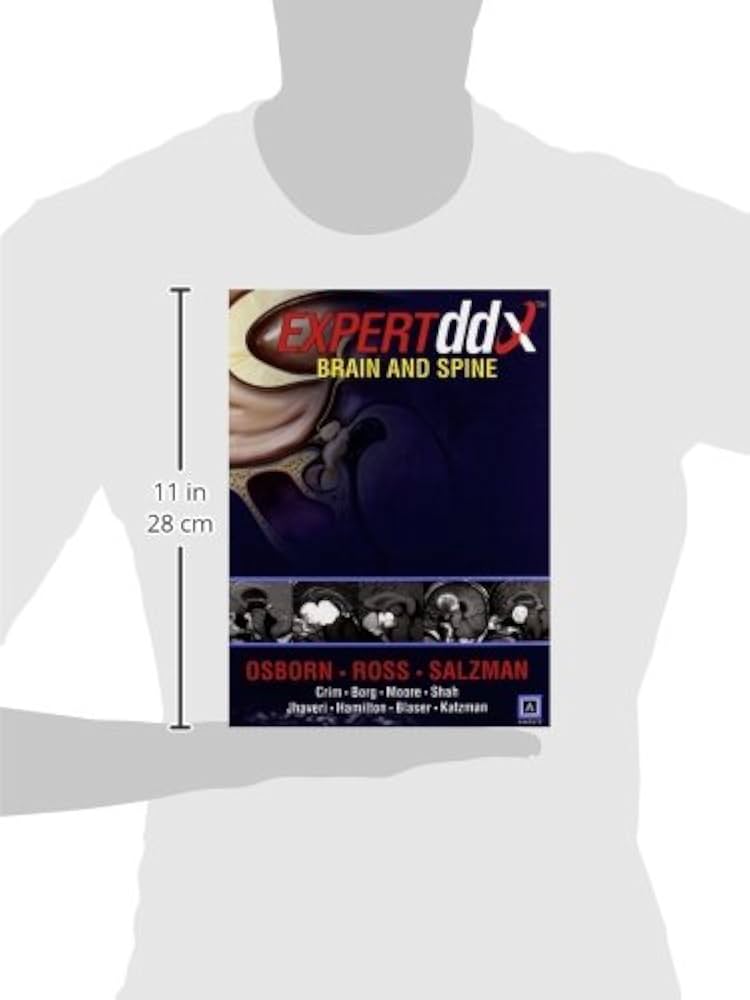Amazon.co.jp: EXPERTddx™: Brain and Spine (Expert Differential