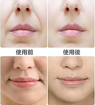 Amazon | フェイスエクササイザー フェイストレーナー 口 くわえる