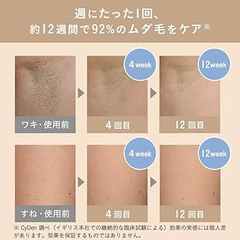 Amazon | スムーズスキン 脱毛器 bare pop 光美容器 IPL光脱毛器